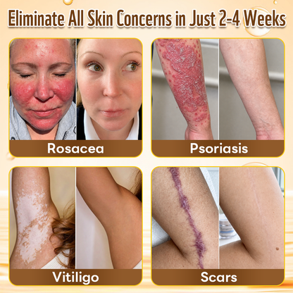 ✨HISKIN® Multi-Concern Skin Repair Cream (One powerful cream to repair inflammation, dryness, aging, pigmentation, and visible skin damage.)