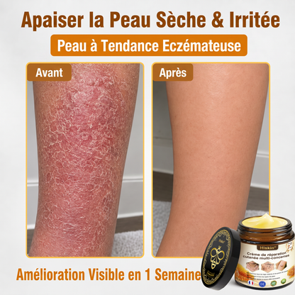 ✨ HISKIN® Technologie Avancée de Renouvellement Cellulaire  Une formule innovante qui agit au cœur de la peau pour soutenir le renouvellement cutané et aider votre peau à retrouver une apparence plus jeune, lisse et éclatante.