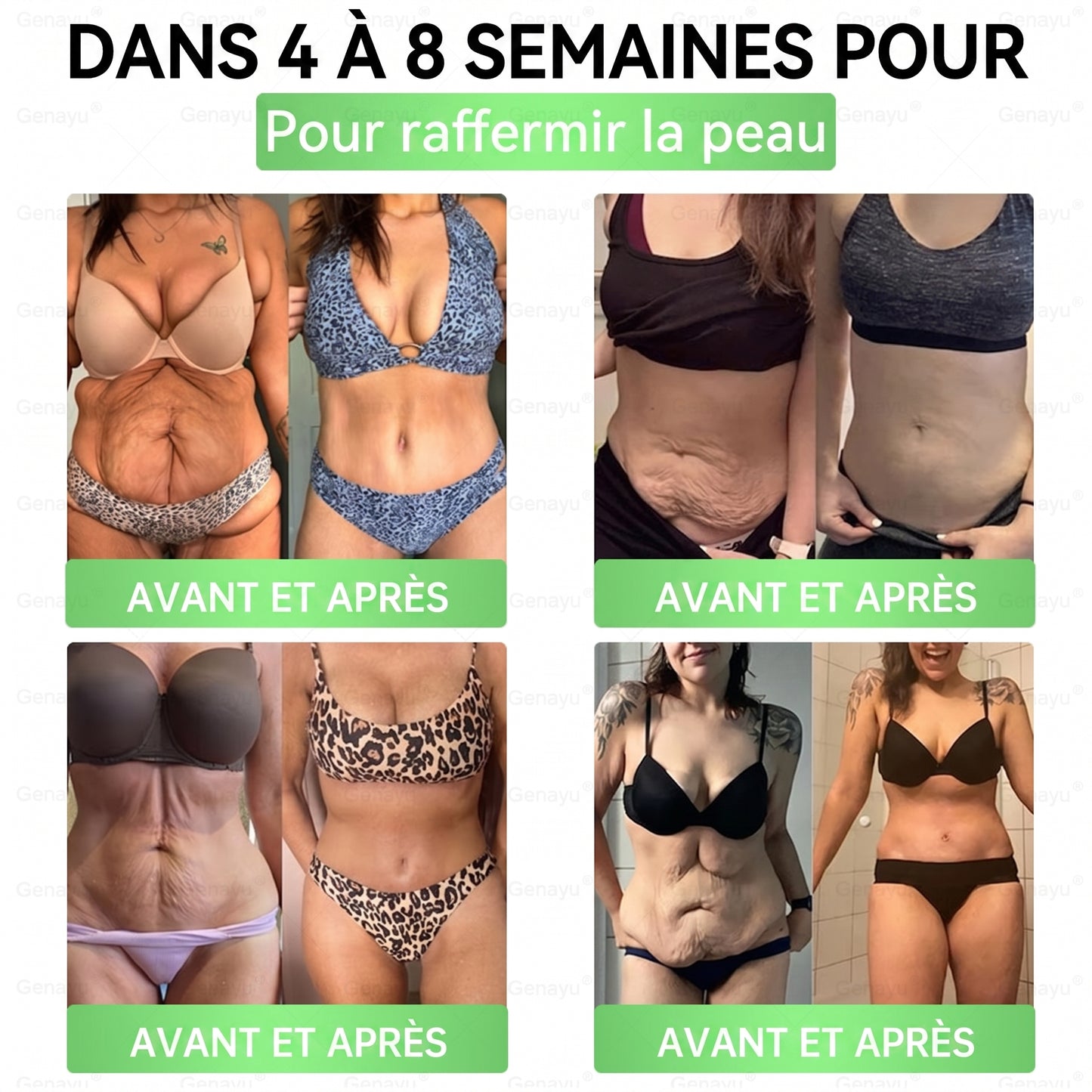 𝑫𝒆𝒓𝒏𝒊è𝒓𝒆 𝒄𝒉𝒂𝒏𝒄𝒆 ! 30 𝒎𝒊𝒏 𝒂𝒗𝒂𝒏𝒕 𝒓𝒆𝒕𝒐𝒖𝒓 𝒂𝒖 𝒑𝒓𝒊𝒙 𝒑𝒍𝒆𝒊𝒏 ⏰ 𝑮𝒆𝒏𝒂𝒚𝒖® 𝑷𝒂𝒕𝒄𝒉 𝑨𝒎𝒊𝒏𝒄𝒊𝒔𝒔𝒂𝒏𝒕 𝑴𝒐𝒓𝒊𝒏𝒈𝒂 × 𝑩𝒆𝒓𝒃é𝒓𝒊𝒏𝒆 × 𝑵𝑨𝑫+ 10 𝑩𝒊𝒆𝒏𝒇𝒂𝒊𝒕𝒔 — 1×/𝒋𝒐𝒖𝒓, 𝒓é𝒔𝒖𝒍𝒕𝒂𝒕𝒔 𝒗𝒊𝒔𝒊𝒃𝒍𝒆𝒔 𝒆𝒏 7 𝒋𝒐𝒖𝒓𝒔 ✅ 𝑨𝒊𝒅𝒆 𝒐𝒃é𝒔𝒊𝒕é, 𝒑𝒆𝒂𝒖 𝒓𝒆𝒍â𝒄𝒉é𝒆, 𝒅𝒊𝒂𝒃è𝒕𝒆, 𝒕𝒆𝒏𝒔𝒊𝒐𝒏, 𝒂𝒑𝒏é𝒆, 𝒂𝒓𝒕𝒊𝒄𝒖𝒍𝒂𝒕𝒊𝒐𝒏𝒔 🎈