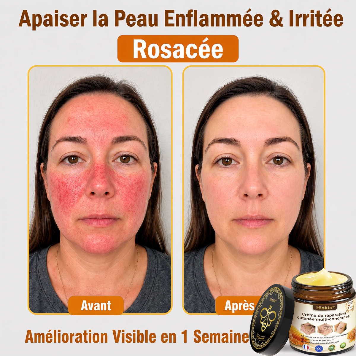 ✨ HISKIN® Technologie Avancée de Renouvellement Cellulaire  Une formule innovante qui agit au cœur de la peau pour soutenir le renouvellement cutané et aider votre peau à retrouver une apparence plus jeune, lisse et éclatante.