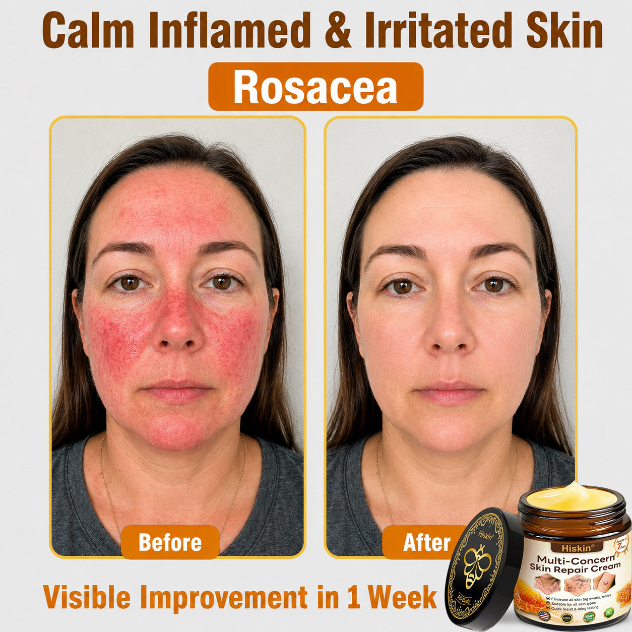 ✨HISKIN® Multi-Concern Skin Repair Cream (One powerful cream to repair inflammation, dryness, aging, pigmentation, and visible skin damage.)