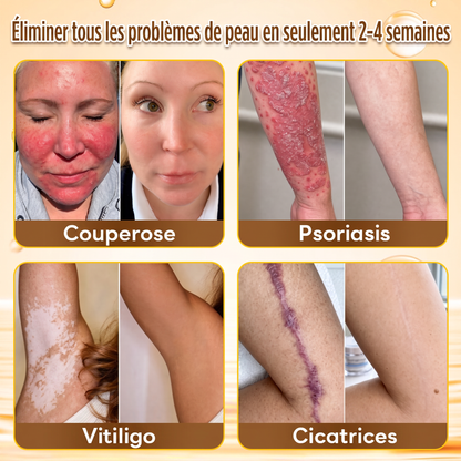 ✨ HISKIN® Technologie Avancée de Renouvellement Cellulaire  Une formule innovante qui agit au cœur de la peau pour soutenir le renouvellement cutané et aider votre peau à retrouver une apparence plus jeune, lisse et éclatante.