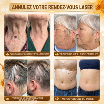 ✨ HISKIN® Technologie Avancée de Renouvellement Cellulaire  Une formule innovante qui agit au cœur de la peau pour soutenir le renouvellement cutané et aider votre peau à retrouver une apparence plus jeune, lisse et éclatante.
