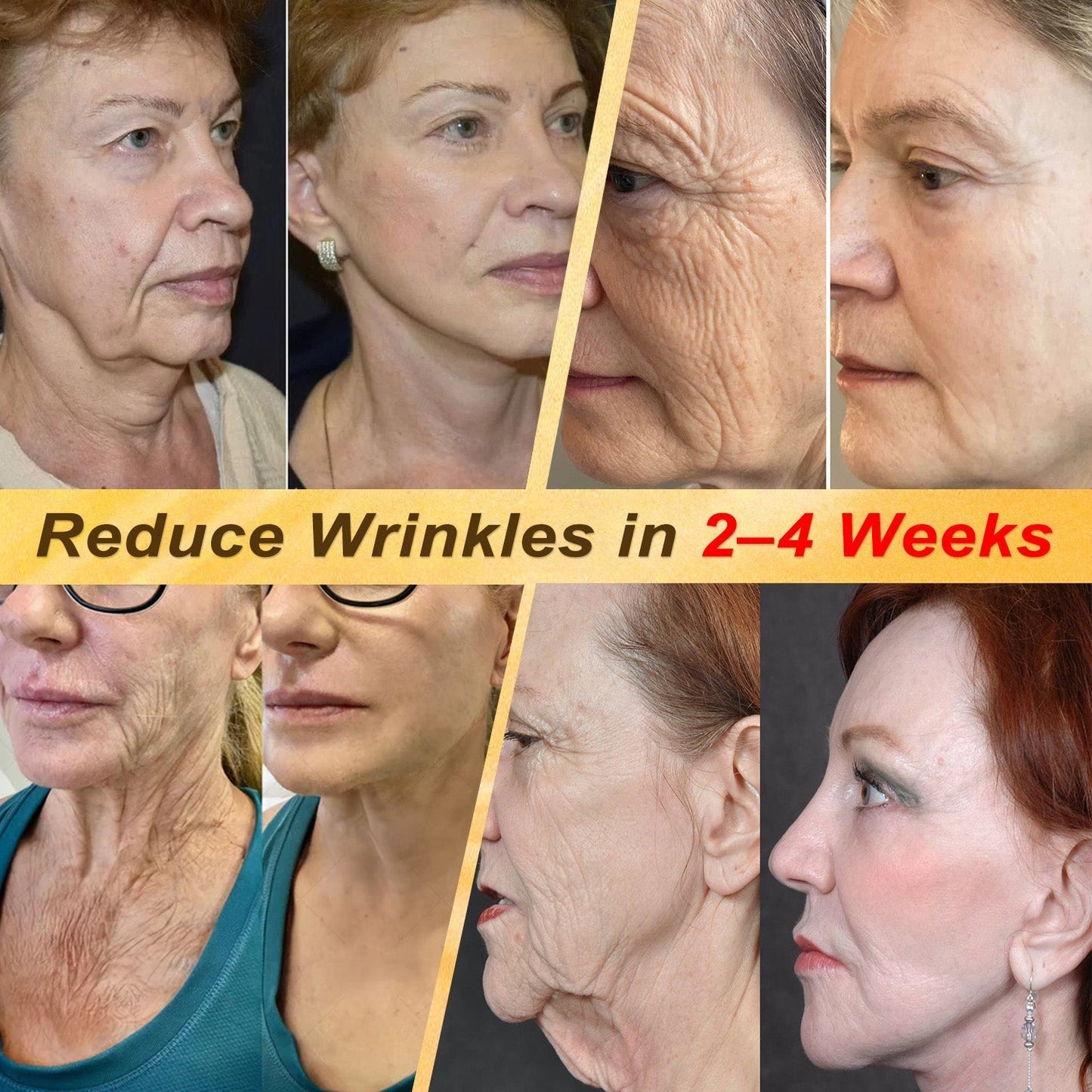 ✨HISKIN® Multi-Concern Skin Repair Cream (One powerful cream to repair inflammation, dryness, aging, pigmentation, and visible skin damage.)