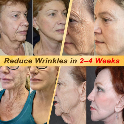 ✨HISKIN® Multi-Concern Skin Repair Cream (One powerful cream to repair inflammation, dryness, aging, pigmentation, and visible skin damage.)