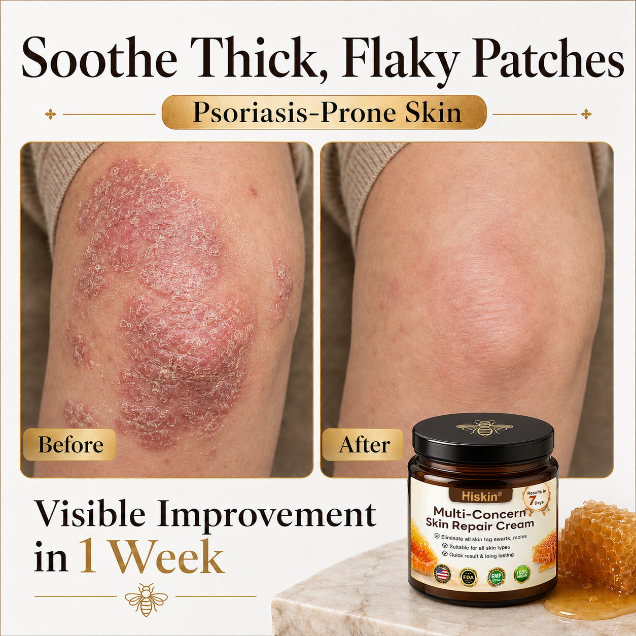✨HISKIN® Multi-Concern Skin Repair Cream (One powerful cream to repair inflammation, dryness, aging, pigmentation, and visible skin damage.)